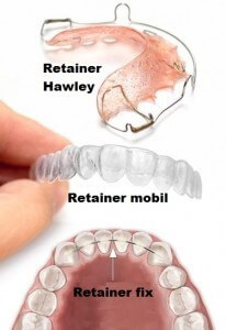 Sfaturi pentru purtătorii de aparate dentare ortodontice