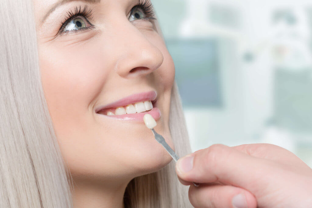 fatete dentare bucuresti