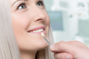 fatete dentare bucuresti