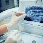 radiografie dentara