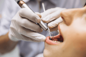 tratament carii dentare