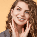 indepartare aparat dentar